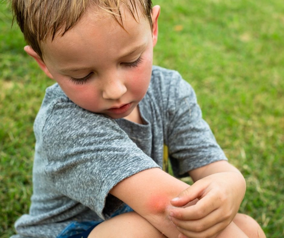 Boy is bitten by a bug- Bug-free yard